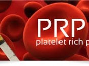 prp για την αρθρίτιδα του γόνατος