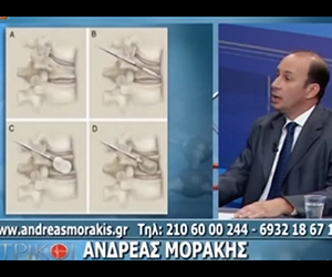 οστεοπορωτικά κατάγματα